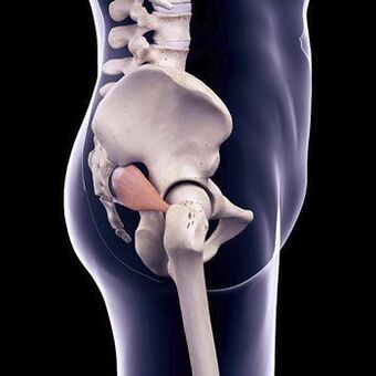 Dagger back pain may be due to a spasm of the piriformis muscle