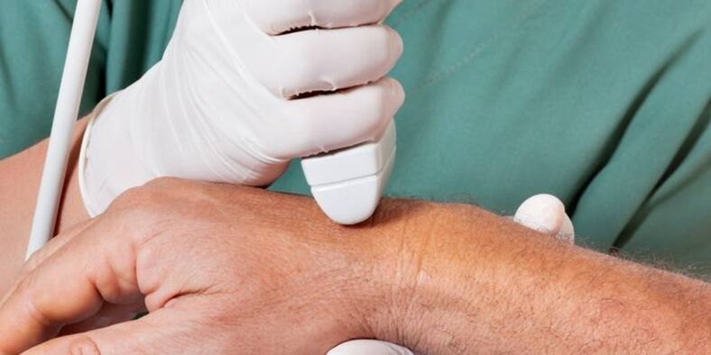 arthritis as causes of pain in fingers